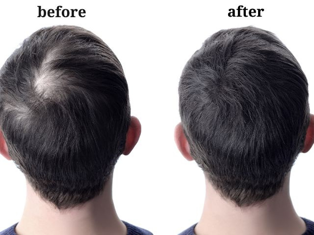 Very Profitable Hair Replacement and Restoration Business